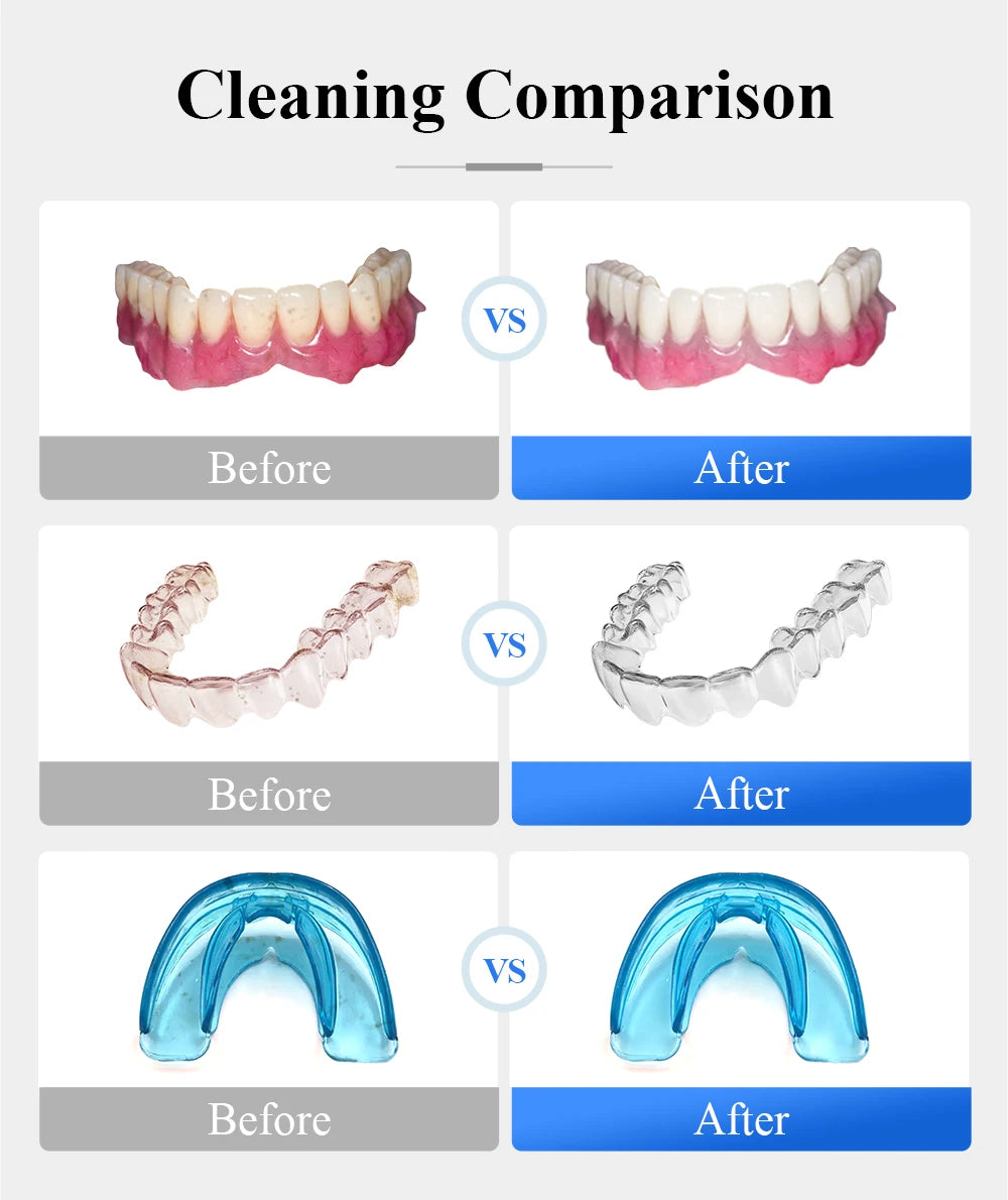 Ultrasonic Retainer Cleaner for Denture Jewelry Braces Cleaning with UV Light