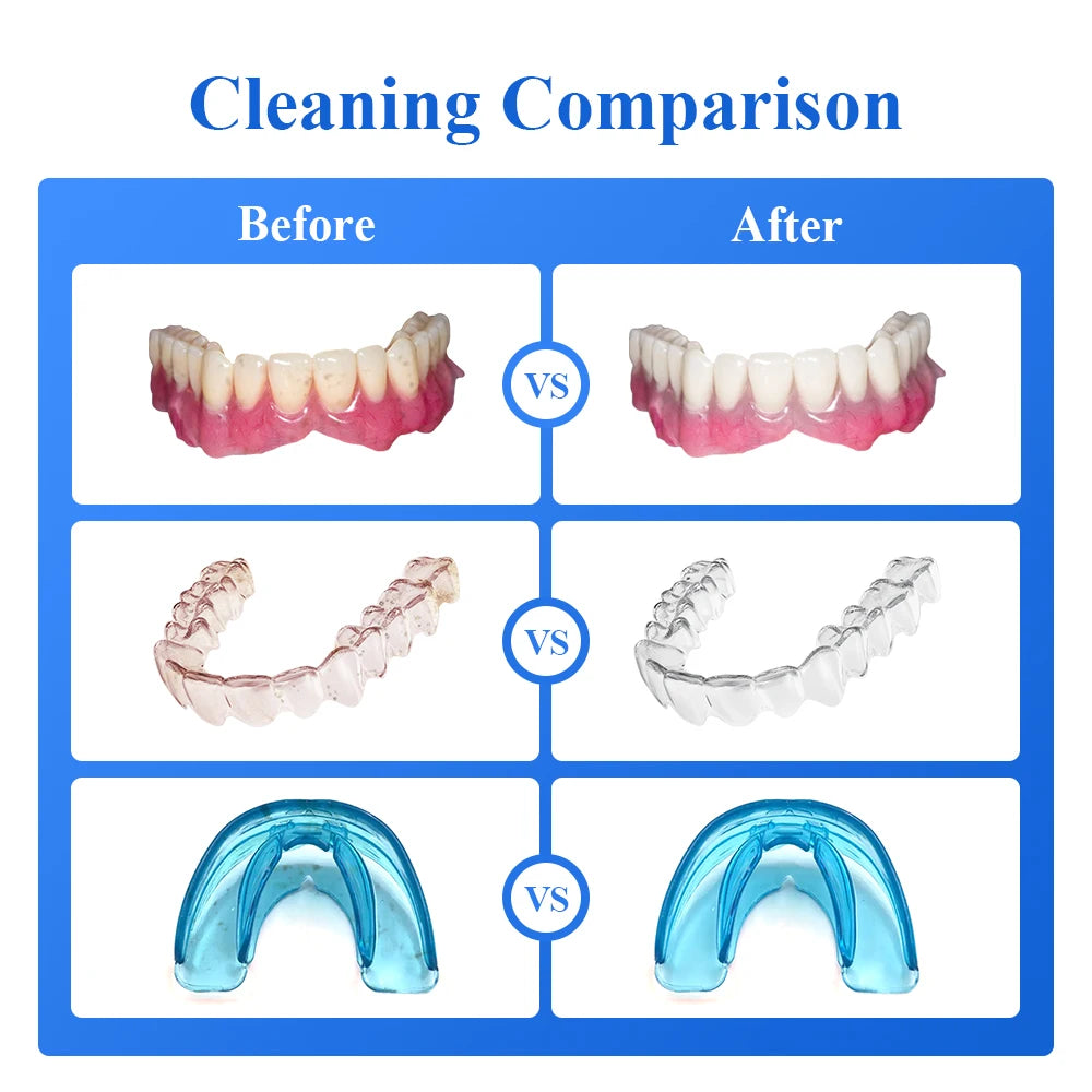 Ultrasonic Retainer Cleaner for Denture Jewelry Braces Cleaning with UV Light