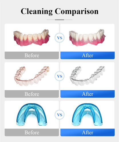 Ultrasonic Retainer Cleaner for Denture Jewelry Braces Cleaning with UV Light